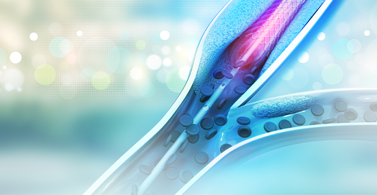 Interventional Cardiology stent or catheter used in surgeries in medical center Sharjah