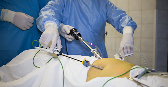 Shock Wave Lithotripsy Shock Wave Lithotripsy