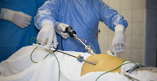 Shock Wave Lithotripsy