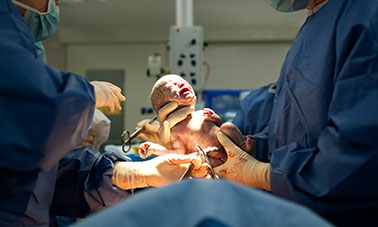 باقة الولادة القيصرية الأساسية