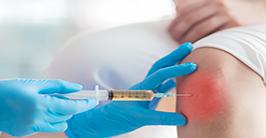 Intra Articular Injection Intra Articular Injection