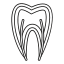 Receding gum line